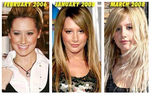 5 Top Reasons for Rhinoplasty (Just in Case You Are Ever on Family Feud) 5 Top Reasons for Rhinoplasty (Just in Case You Are Ever on Family Feud)
