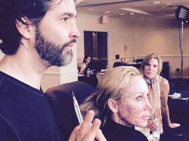 Voluma, What’s New 2015 ? @PerskySunderFacialPlasticSurgery After de Maio Master Injector Technique Course Voluma, What’s New 2015 ? @PerskySunderFacialPlasticSurgery After de Maio Master Injector Technique Course