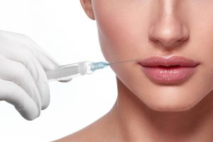 Minimizing Bruising After Facial Filler Injections