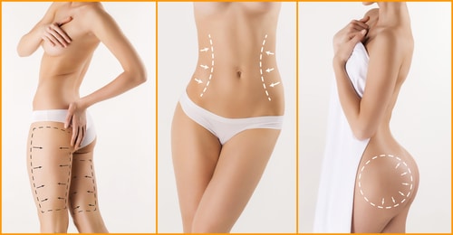 body correction with the help of plastic surgery-img-blog