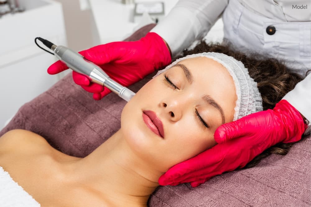 Woman undergoing microneedling treatment at a medical spa.