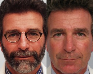 Dr. Michael A. Persky - How Men Can Look 10 Years Younger